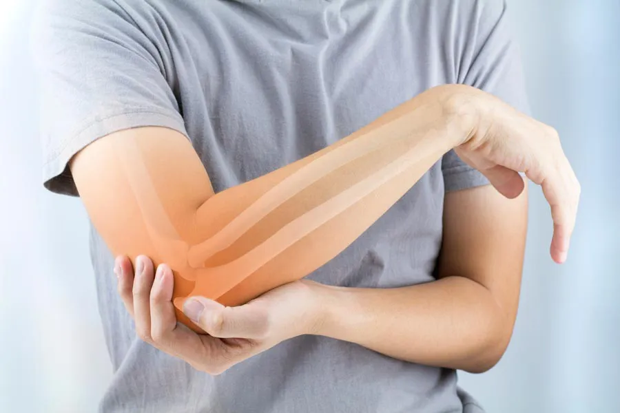 A close-up of a woman holding her elbow with an illustration of the bones and joint experiencing pain from osteoporosis. Get osteoporosis treatment from Allen Green, M.D. of Center for Optimum Health in Los Angeles.