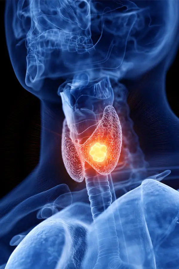 A 3D illustration of an x-ray of a human neck, highlighting the thyroid. Get help with thyroid imbalance from Allen Green, M.D. of Center for Optimum Health in Los Angeles.